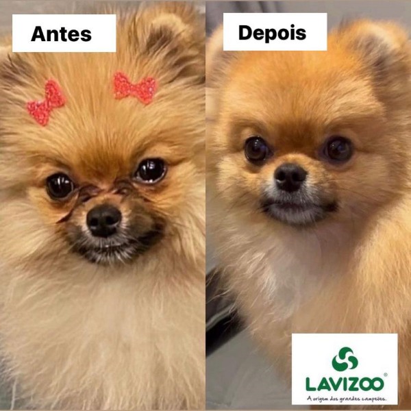 antes e depois de tratamento para l&aacute;grima &aacute;cida com limpa l&aacute;grimas lavizoo